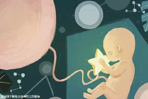 专家